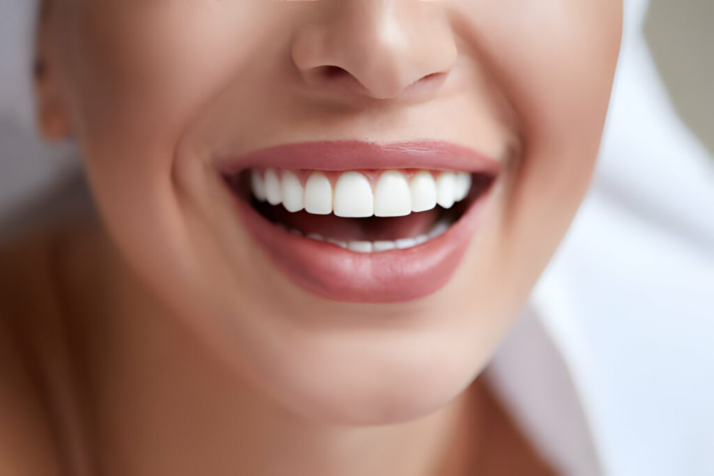 Brighten Your Day: Top 10 Teeth Whitening Methods You Need to Try_1